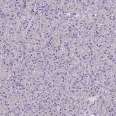 Immunohistochemistry-Paraffin: P2Y13/P2RY13/GPR86 Antibody [NBP2-13721]
