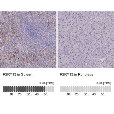 Immunohistochemistry-Paraffin: P2Y13/P2RY13/GPR86 Antibody [NBP2-13721]