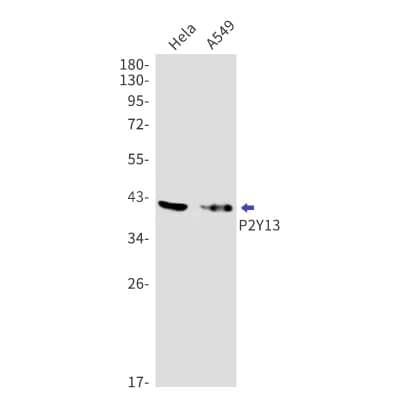 Western Blot: P2Y13/P2RY13/GPR86 Antibody (S02-3I1) [NBP3-19904]