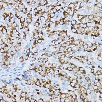 Immunohistochemistry-Paraffin: P2Y14/GPR105 Antibody - BSA Free [NBP2-93909]