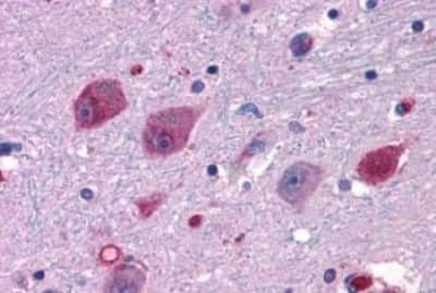 Immunohistochemistry-Paraffin: P2Y14/GPR105 Antibody [NBP3-14438]