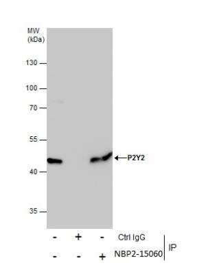 Immunoprecipitation: P2Y2 Antibody [NBP2-15060]