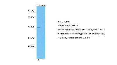 Western Blot: P2Y2 Antibody [NBP2-86745]