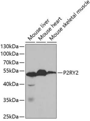 Western Blot: P2Y2 AntibodyBSA Free [NBP2-94356]