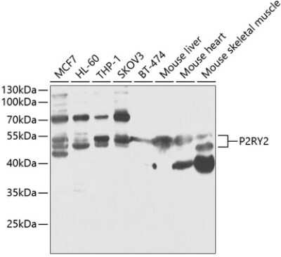 Western Blot: P2Y2 AntibodyBSA Free [NBP2-94751]