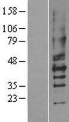 Western Blot: P2Y2 Overexpression Lysate [NBL1-14044]