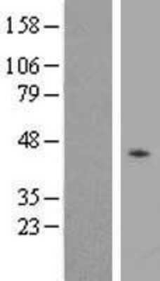 Western Blot: P2Y2 Overexpression Lysate [NBL1-14045]