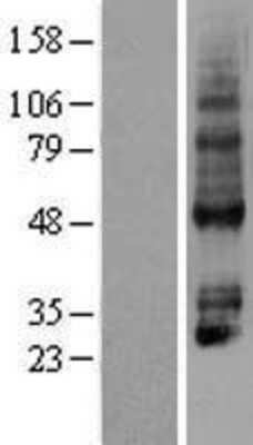 Western Blot: P2Y4/P2RY4 Overexpression Lysate [NBP2-04229]