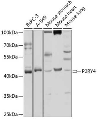 Western Blot: P2Y4/P2RY4 AntibodyBSA Free [NBP2-95193]