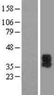 Western Blot: P2Y6/P2RY6 Overexpression Lysate [NBL1-14048]