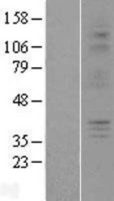 Western Blot: P2Y6/P2RY6 Overexpression Lysate [NBL1-14049]