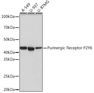 Western Blot: P2Y6/P2RY6 Antibody (4I8C9) [NBP3-16259]