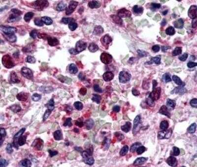 Immunohistochemistry-Paraffin: P2Y6/P2RY6 Antibody - BSA Free [NLS877]
