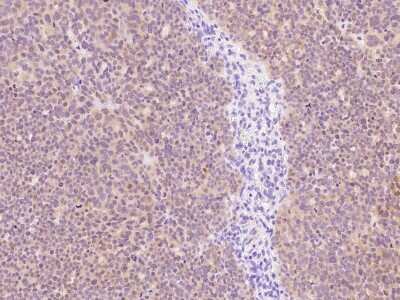 Immunohistochemistry-Paraffin: P2Y6/P2RY6 Antibody [NBP2-99485]