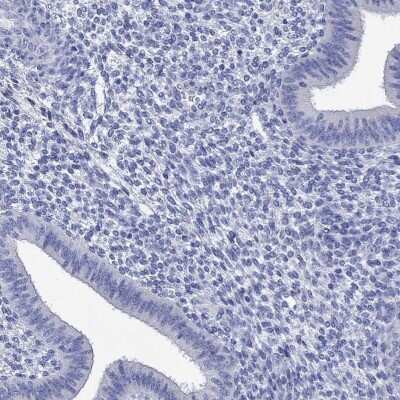 Immunohistochemistry-Paraffin: P2Y6/P2RY6 Antibody [NBP3-17041]