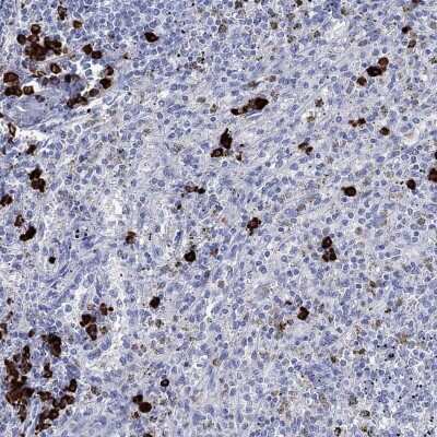 Immunohistochemistry-Paraffin: P2Y6/P2RY6 Antibody [NBP3-17041]
