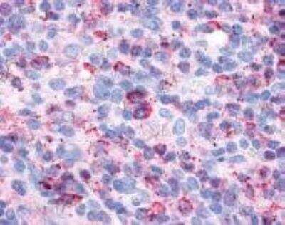 Immunohistochemistry-Paraffin: P2Y6/P2RY6 Antibody - BSA Free [NLS2726]