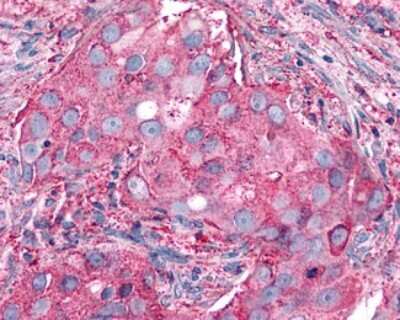 Immunohistochemistry-Paraffin: P2Y6/P2RY6 Antibody - BSA Free [NLS2726]