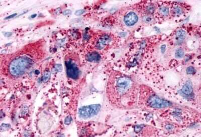 Immunohistochemistry-Paraffin: P2Y6/P2RY6 Antibody - BSA Free [NLS2726]