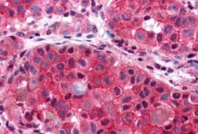 Immunohistochemistry-Paraffin: P2Y6/P2RY6 Antibody - BSA Free [NLS877]