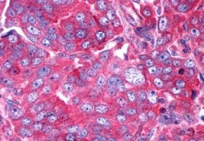 Immunohistochemistry-Paraffin: P2Y6/P2RY6 Antibody - BSA Free [NLS877]
