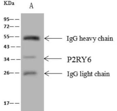 Immunoprecipitation: P2Y6/P2RY6 Antibody [NBP2-99485]