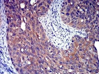 Immunohistochemistry: P2Y8 Antibody (1G5A11) - BSA Free [NBP2-61761]