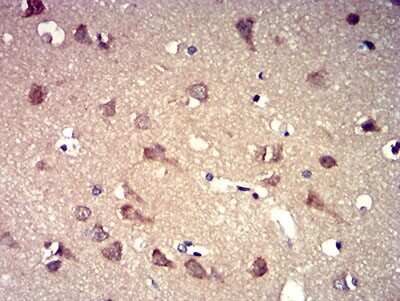 Immunohistochemistry: P2Y8 Antibody (1G5A11) - BSA Free [NBP2-61761]