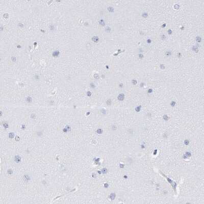 Immunohistochemistry-Paraffin: P2Y8 Antibody [NBP1-87375]