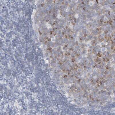 Immunohistochemistry-Paraffin: P2Y8 Antibody [NBP1-87375]