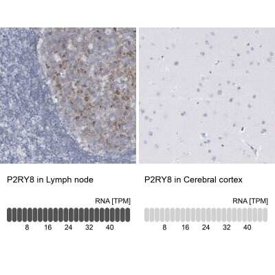 Immunohistochemistry-Paraffin: P2Y8 Antibody [NBP1-87375]