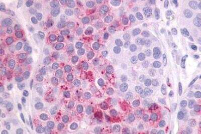 Immunohistochemistry-Paraffin: LPAR4/LPA4 Antibody - BSA Free [NLS1895]