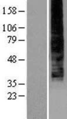 Western Blot: LPAR4/LPA4 Overexpression Lysate [NBP2-04286]