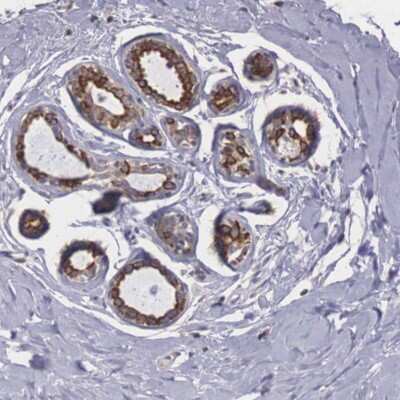 Immunohistochemistry-Paraffin: P311 Antibody [NBP1-84315]