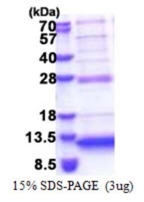 SDS-PAGE: Recombinant Human P311 His Protein [NBP2-23281]