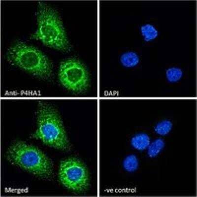 Immunocytochemistry/ Immunofluorescence: P4HA1 Antibody [NB100-57852]