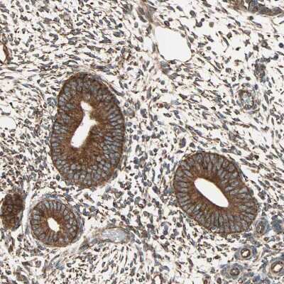 Immunohistochemistry-Paraffin: P4HA1 Antibody [NBP1-84397]