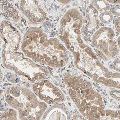 Immunohistochemistry-Paraffin: P4HA1 Antibody [NBP1-84397]