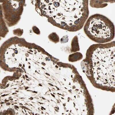 Immunohistochemistry-Paraffin: P4HA1 Antibody [NBP1-84397]