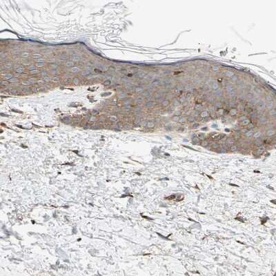Immunohistochemistry-Paraffin: P4HA1 Antibody [NBP1-84397]