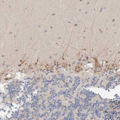 Immunohistochemistry-Paraffin: P4HA1 Antibody [NBP1-84398]