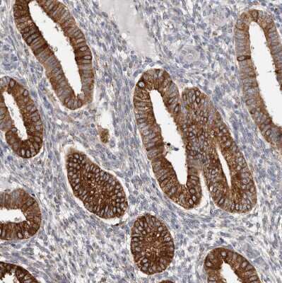 Immunohistochemistry-Paraffin: P4HA1 Antibody [NBP1-84398]