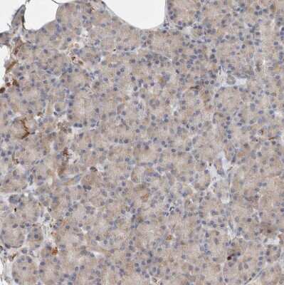 Immunohistochemistry-Paraffin: P4HA1 Antibody [NBP1-84398]