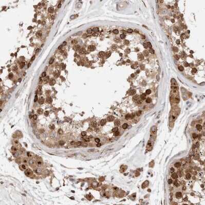 Immunohistochemistry-Paraffin: P4HA1 Antibody [NBP1-84398]