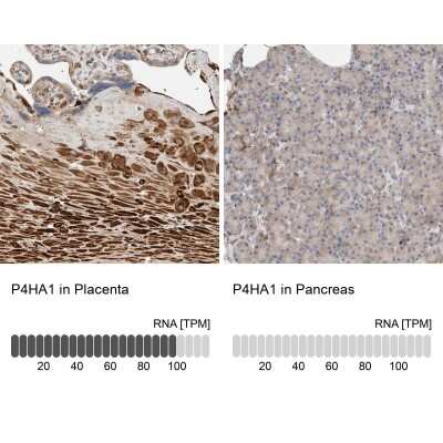 Immunohistochemistry-Paraffin: P4HA1 Antibody [NBP1-84398]