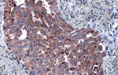 Immunohistochemistry-Paraffin: P4HA1 Antibody [NBP2-19664]