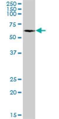 Western Blot: P4HA1 Antibody [H00005033-B01P]