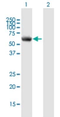 Western Blot: P4HA1 Antibody [H00005033-B01P]