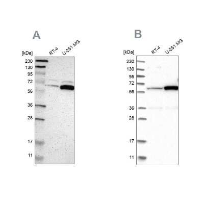 Western Blot: P4HA1 Antibody [NBP1-84397]