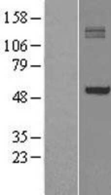 Western Blot: P4HA1 Overexpression Lysate [NBL1-14050]